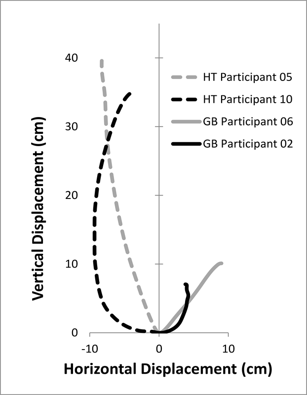 2-dimensional barbell displacement for the HT and GB in participants with higher and smaller displacement vector indexes