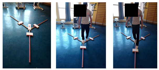 
Y-Balance Test Procedure Demonstrating the Three Reach Directions (Anterior, Posteromedial, and Posterolateral)
